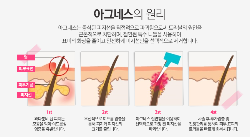 이미지명
