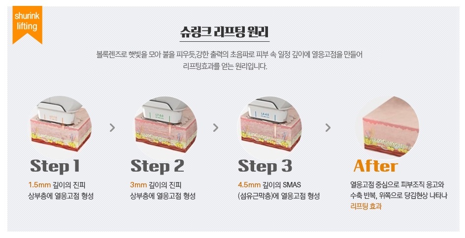 이미지명