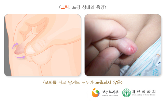이미지명