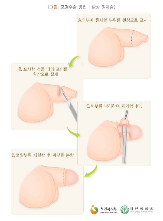 이미지명